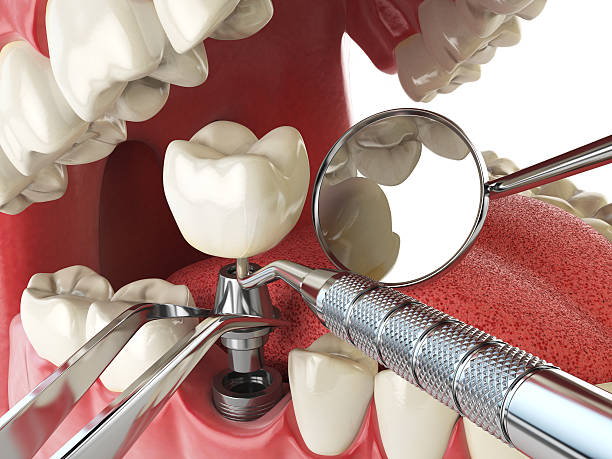 Best Emergency Denture Repair in Midlothian, VA